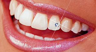 Ästhetische Eingriffe in der Zahnbehandlung